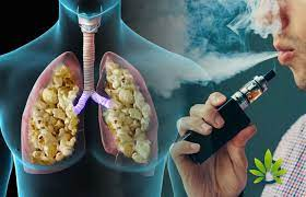 Is it True That Vaping Can Cause Popcorn Lung cometovape