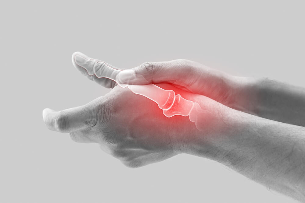 Could CBD Help with Different Arthritis Conditions?